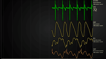 JavaScript Medical Dashboard - Example of a Medical Dashboard with ECG/EKG, blood pressure, flow volume and oxygen saturation.
