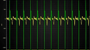 JavaScript ECG Chart with Highlighted Beats - Example showcasing Line Series feature for coloring line dynamically based on X coordinates