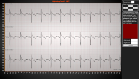ECGPaperGrid