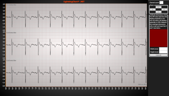 ECGPaperGrid