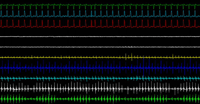 Example of SampleDataBlockSeries