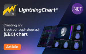 Electroencephalograph (EEG) chart