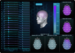 EEG Visualization showcase LightningChart .NET
