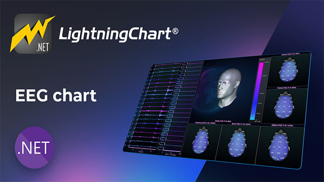 EEG .NET chart