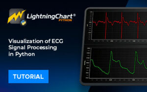 newspost Visualization of ECG Signal Processing in Python
