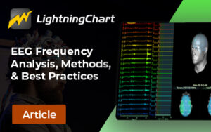 EEG-Frequency-Analysis-FI